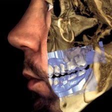 Cirugía Oral y Maxilofacial